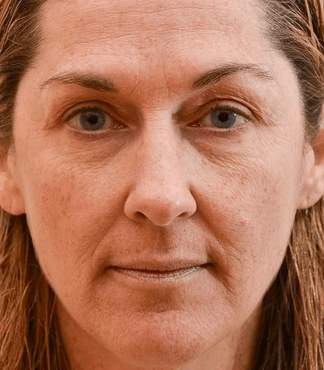 Mein Gesicht vor der Verwendung von Eudalie -Creme